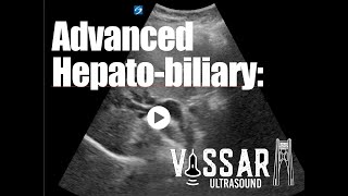 Advanced HepatoBiliary [upl. by Sirroned]