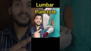 Lumbar Puncture shorts [upl. by Aseret700]