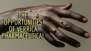 The Opportunities of Verrica Pharmaceuticals NASDAQ VRCA Bitesized episode [upl. by Schulman]