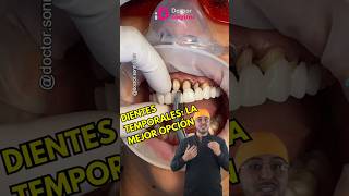 Para que son los provisionales protesisdental carillasdentales protesista dentista shorts [upl. by Mcdade372]