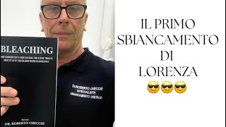 La storia di Lorenza e del suo sbiancamento dentale [upl. by Bushweller]