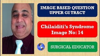 CHILAIDITIS SYNDROME Upper GI Tract Image Based Question [upl. by Ahseeyt]