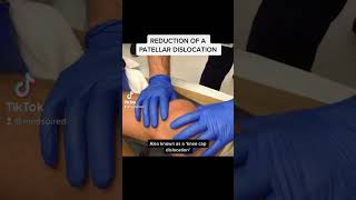 Reduction of a Patellar Dislocation [upl. by Sapienza775]