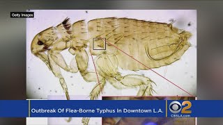 Downtown LA Hit With Outbreak Of FleaBorne Typhus [upl. by Nawtna]