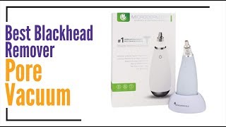 Best Blackhead Remover Pore Vacuum  Microderm GLO MINI Diamond Microdermabrasion [upl. by Monah]