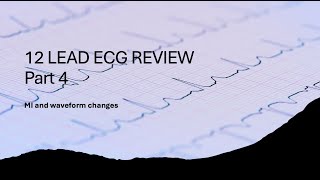 12 Lead Review Part 4 MI and Waveform Changes [upl. by Coopersmith]