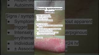 Chronic spontaneous urticaria [upl. by Eibloc]