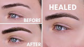 Microblading Experience  Before amp After  10 Day Healing Process [upl. by Ariaek]