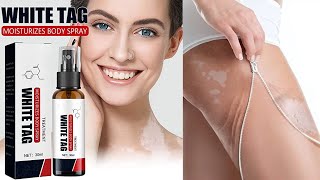 Dermax Psoriasis Treatment Spray 2022 [upl. by Latty]