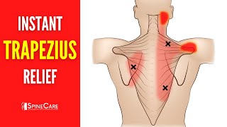 How to Relieve Trapezius Pain FOR GOOD [upl. by Allisan8]