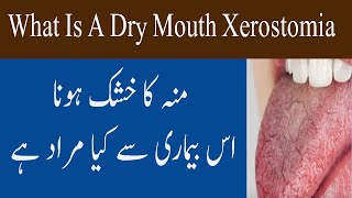 What Is Dry Mouth Xerostomia Condition In Urdu Hindi Muh Khushk Hona Ki Bimari [upl. by Zedecrem]