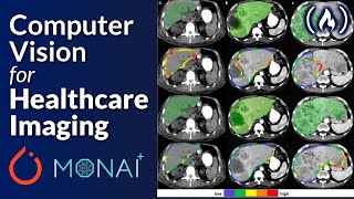 PyTorch and Monai for AI Healthcare Imaging  Python Machine Learning Course [upl. by Bancroft]