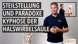 Steilstellung und paradoxe Kyphose der Halswirbelsäule [upl. by Aggarwal715]