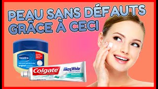 astuce simple pour soigner les imperfections et infections de la peau [upl. by Armil]