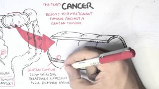 Cancer  Introduction I [upl. by Latsyrd]