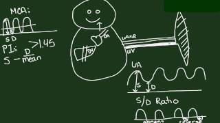 Fetal Circulation and Doppler Studies [upl. by Eiramlatsyrc99]