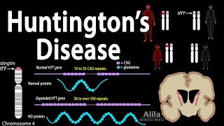 Huntingtons Disease Genetics Pathology and Symptoms Animation [upl. by Bibbye716]