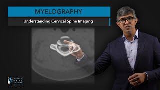 What is Myelography​ of the Cervical Spine [upl. by Aratahc]