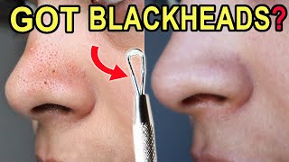 How I Clean Congested Pores on the nose you should have one at home [upl. by Yenhoj238]