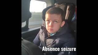 absence seizurepetit mal seizure [upl. by Concettina640]