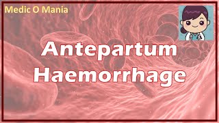 Antepartum Hemorrhage  APH Management प्रसवपूर्व रक्तस्राव प्रबंधन HINDI [upl. by Clapper532]