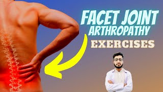 Facet Joint Arthropathy Exercises Treatment Physiotherapy  L4L5 L5S1 facet joint pain relief [upl. by Lytsyrk]