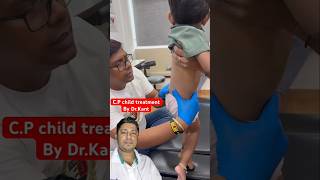 CP child treatment chiropractickalyan physiotherapy chiropractic chiropractor baby sports [upl. by Otrebire]