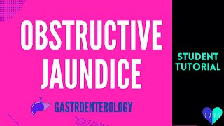 Obstructive Jaundice  Medical Tutorial [upl. by Elletnuahc507]