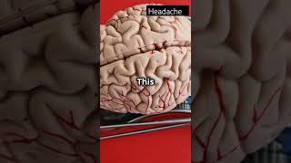 Ancient Brain Surgery Trepanation Explainedhealth science facts history surgun [upl. by Seleta]