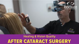 Recovery amp Vision Expectations After Cataract Surgery [upl. by Doownyl]