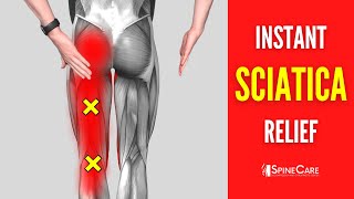 How to Fix Sciatica Pain at Home [upl. by Aphra]