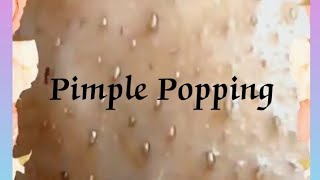 Pimple amp Blackheads Popping  37 [upl. by Aristotle]