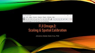 FIJI ImageJ Scaling amp Spatial Calibration [upl. by Laflam782]