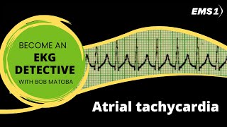 Atrial tachycardia  EKG Detective [upl. by Akamaozu]