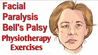 Facial Exercises for Bells Palsy  Facial Palsy [upl. by Enneillij]