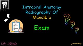 Normal radiographic anatomical landmarksIntraoral Radiographic Anatomy of the Mandible Dental exam [upl. by Alekim]