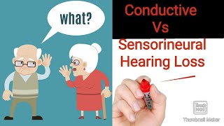 Difference Between Conductive and Sensorineural Hearing Loss  Hand Made Notes [upl. by Bushey]