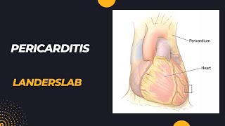 Pericarditis [upl. by Heddi]