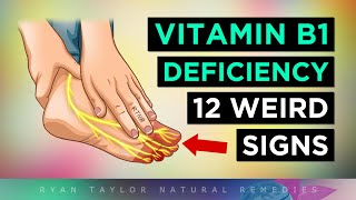 12 Strange Signs Your Body NEEDS Vitamin B1 [upl. by Ayerf]