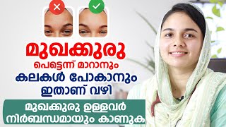 മുഖക്കുരു Acne Pimples പെട്ടെന്ന് മാറാനും കലകൾ പോകാനും ഇതാണ് വഴി [upl. by Malcah573]