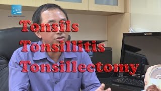 Tonsils Tonsillitis Tonsillectomy [upl. by Cyrillus]