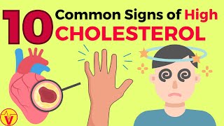 10 Common Signs of High CHOLESTEROL You SHOULD NOT Ignore  VisitJoy [upl. by Ahsiema]