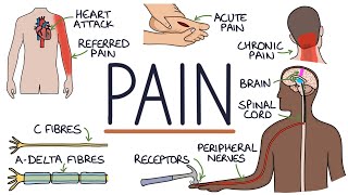 Understanding The Causes of Pain and Pain Management [upl. by Esor]