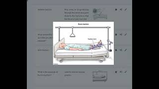 Musculoskeletal Disorders [upl. by Noni]