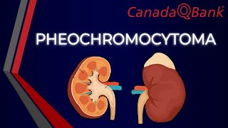 Pheochromocytoma [upl. by Nosyla]