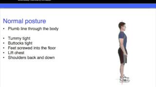 Lordosis kyphosis amp correct posture part 3 [upl. by Georgi]