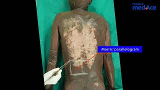 Dissection  Surface Marking Part 1 [upl. by Shelba]