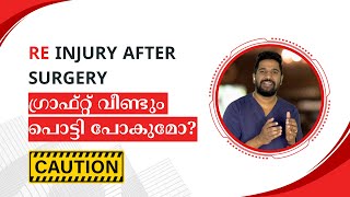 re injury after ligament surgery  ഗ്രാഫ്റ്റ് വീണ്ടും പൊട്ടി പോകുമോ [upl. by Gabler]