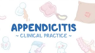 Appendicitis sign symptoms Treatment Homeopathic world [upl. by Milly397]