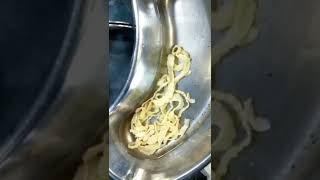 Tapeworm cestodes Surgical Removal In A Patient  Informative Video [upl. by Fihsak]